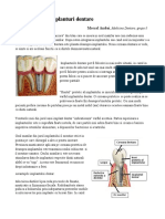 Implanturi Dentare