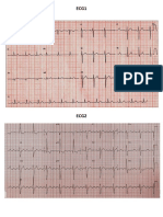 ECGs