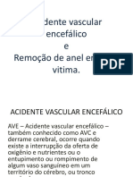 Acidente Vascular