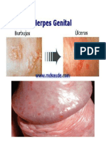 Herpes Genital: Causes, Symptoms & Treatment
