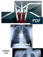 Xray