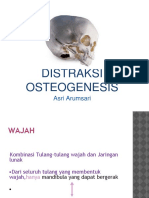 Distraksi Osteogenesis
