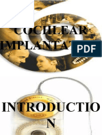 Cochlear Implantation