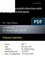 Acute Myocardial Infarction With ST Segment Elevation