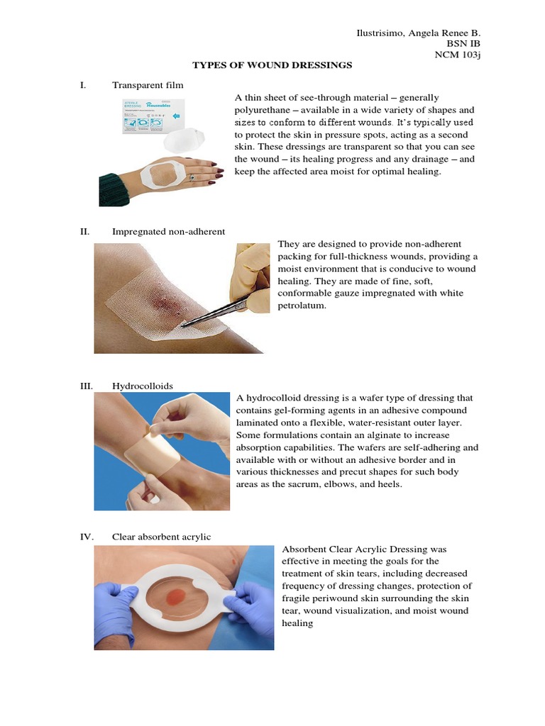 wound types and dressings Traditional wound dressings: gauzes, transparent films, foam dressings,...