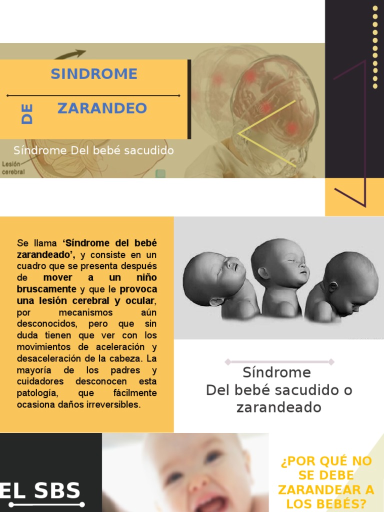 Sindrome De Zarandeo Discapacidad Intelectual Neurologia