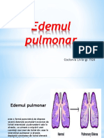 Edem pulmonar