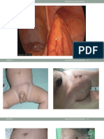 Region Inguinal Crural