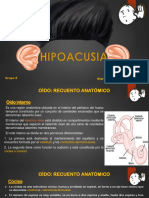 Hipoacusia 