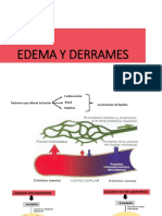 EDEMAS 