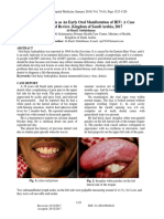 Hairy  Leukoplakia  as  An Early  Oral.pdf