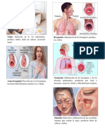 Enfermedades del sitema respiratorio.docx