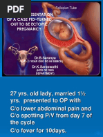 Clinical Presentation of Ectopic Pregnancy Turned Out to Be Ectopic Pregnancy