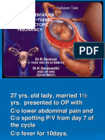 Clinical Presentation of Ectopic Pregnancy Turned Out to Be Ectopic Pregnancy