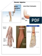 Chronic Injuries