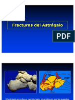 Fracturas Del Astragalo