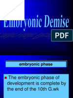 EmbryonicDemise.ppt