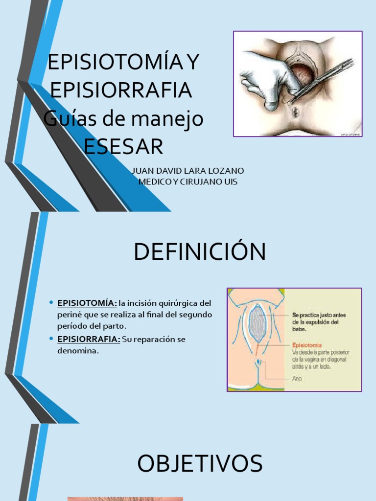 EPISIOTOMIA | Descargar gratis PDF | Parto | Medicina CLINICA