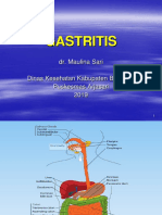 Gastritis