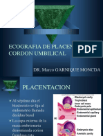 Ecografia de Placenta