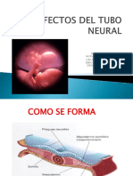 Defectos Del Tubo Neural