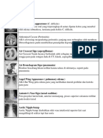 Accordion Sign-Appearance (C. Difficile)