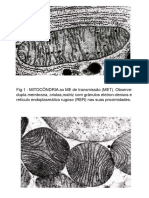 ELETROMICROGRAFIAS - Explicadas