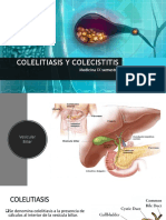 Colelitiasis y Colecistitis