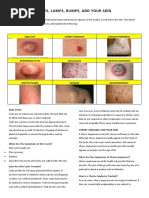 Skin Lumps, Cyst, Bumps 