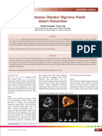 10 - 255keterlambatan Deteksi Higroma Kistik Dalam Kehamilan PDF