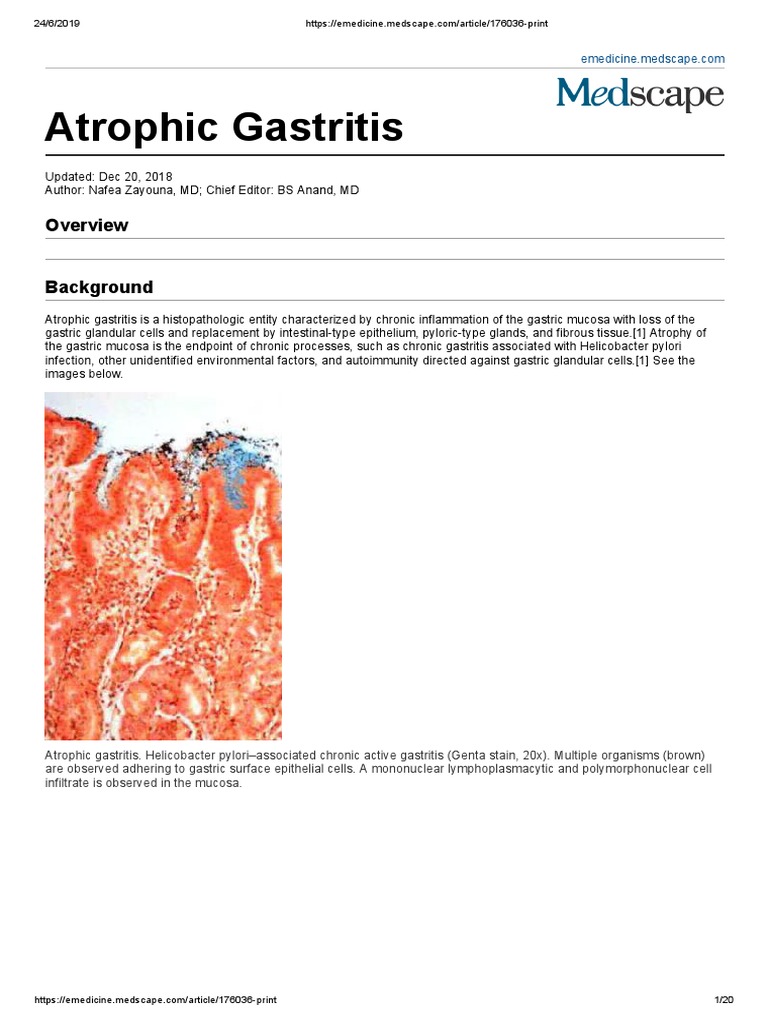 Atrophic Gastritis Pdf Autoimmunity T Helper Cell