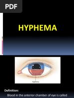 Hyphema