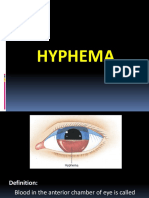 Hyphema