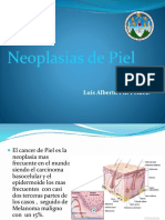 Neoplasiasdepiel 140717235914 Phpapp01 PDF