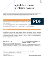 087 dermatoscopía carcinoma basocelular.pdf