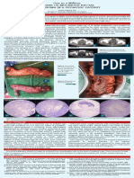 mucinous adenoca in pedia.pdf