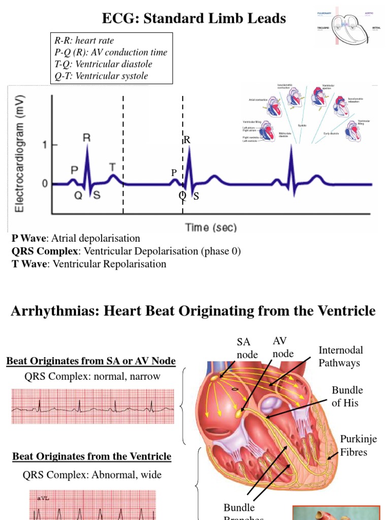 ECG: Standard Limb Leads: R-R: Heart Rate P-Q (R) : AV Conduction Time ...