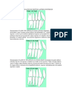 Clasificación de Angle de oclusiones antero-posteriores