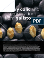 BPJ61 Gallstones