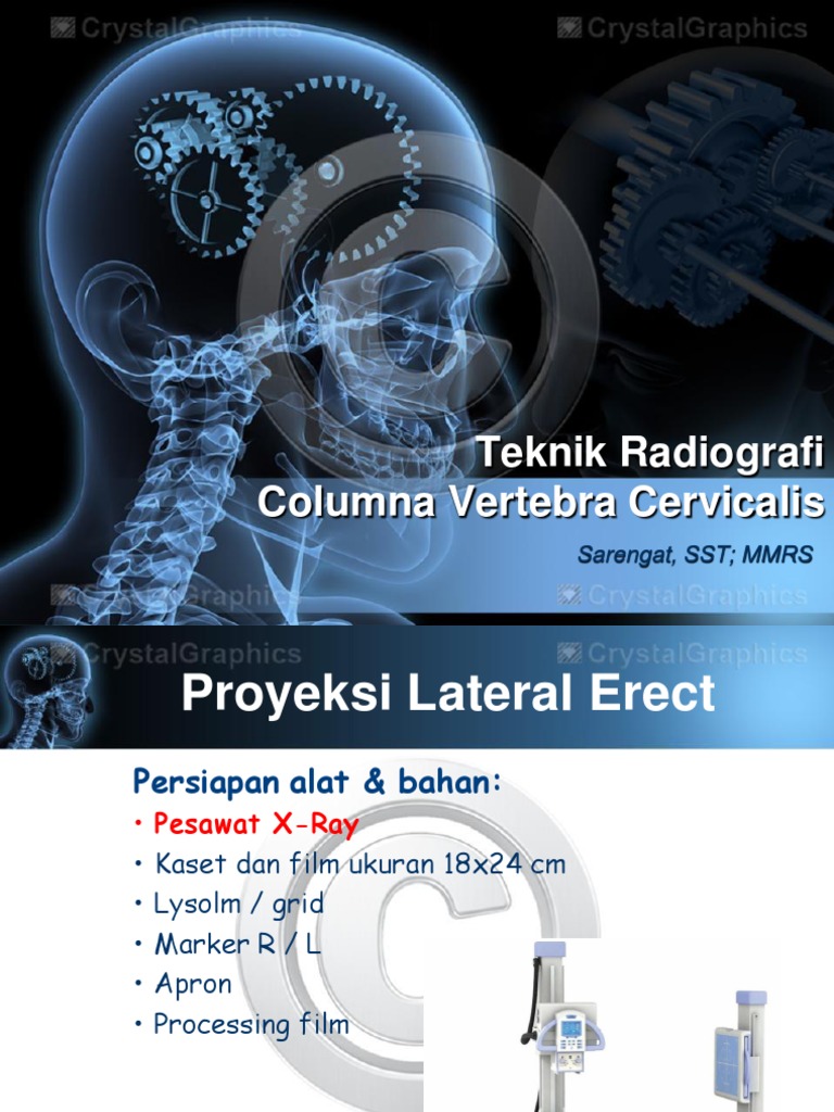 Materi Cervical Lateral | PDF
