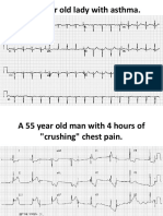 A 34 Year Old Lady With Asthma