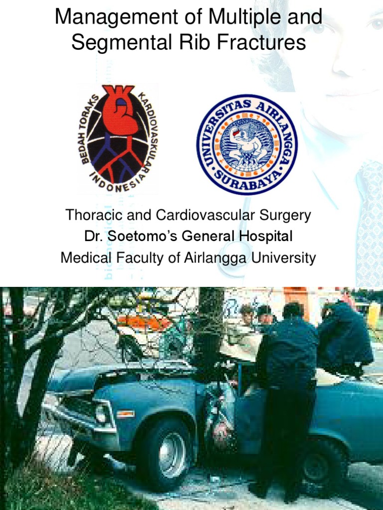 Management of Multiple and Segmental Rib Fractures | PDF | Thorax | Lung
