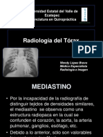 Radiología del mediastino y silueta cardiaca