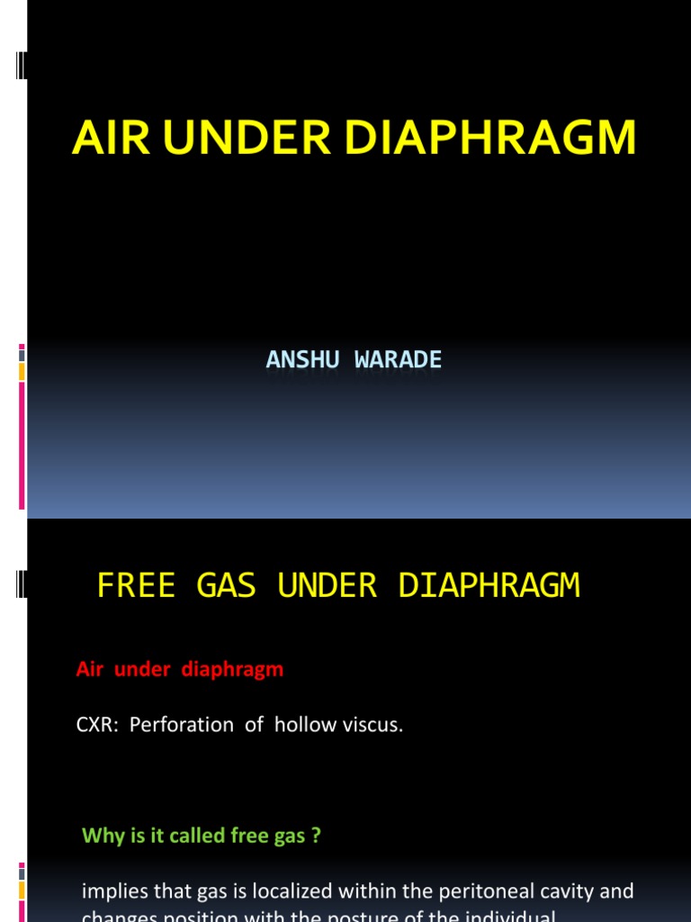 Air Under Diaphragm PDF