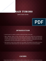 Brain Tumors: Jeselo Ouano Gorme