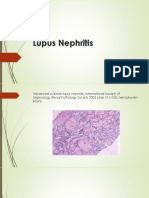 Lupus Nephritis-1.pptx