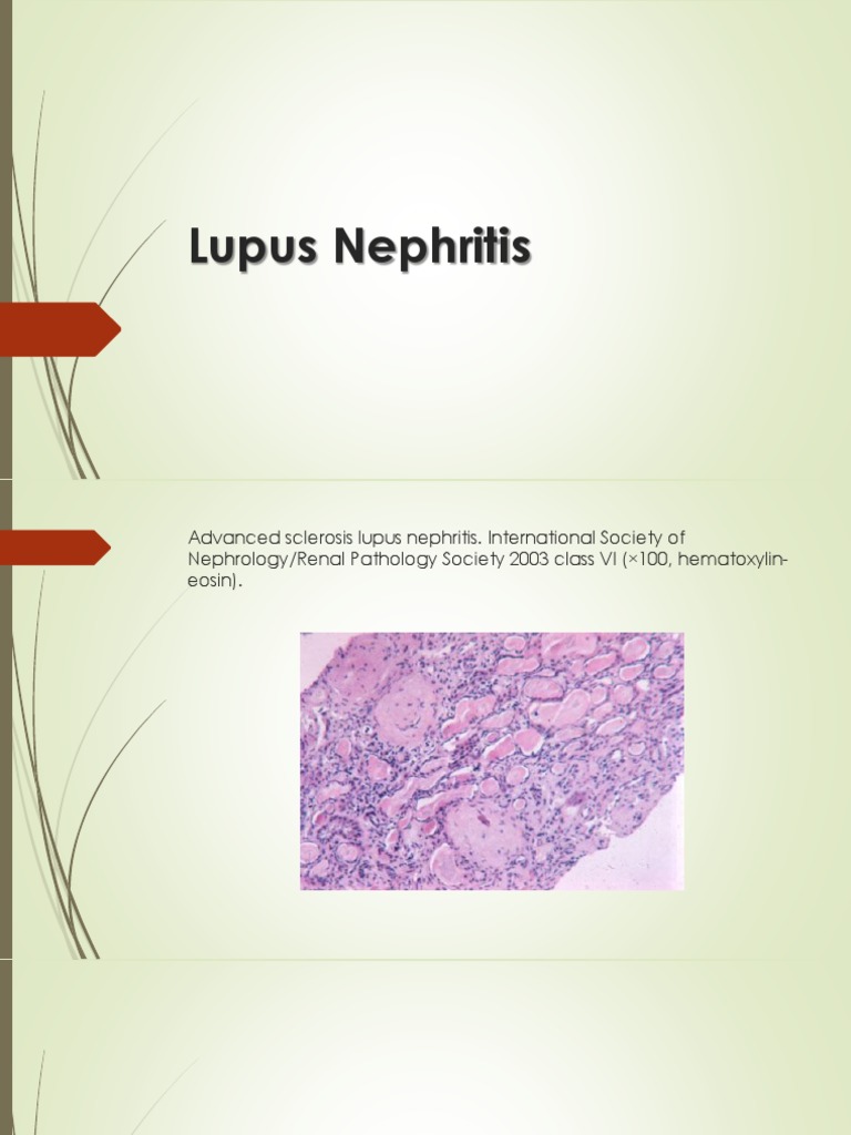 Lupus Nephritis.pptx | Systemic Lupus Erythematosus | Earth & Life Sciences