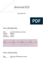 EKG Abnormal.pptx