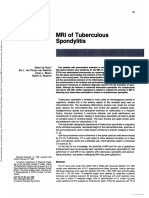 MRI of Tuberculous TB