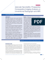 10. Tubercular Spondylitis Prospective Comparative Imaging Analysis On